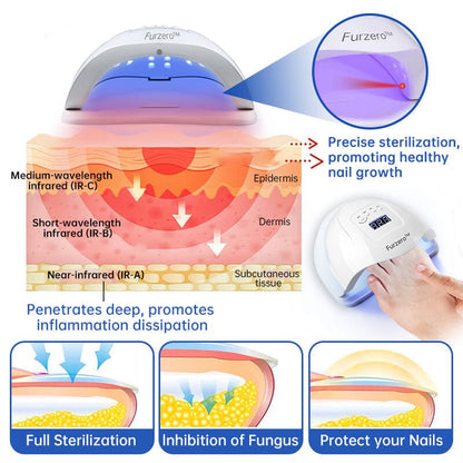 Furzero™ PureNail Fungus Laser Therapy Device