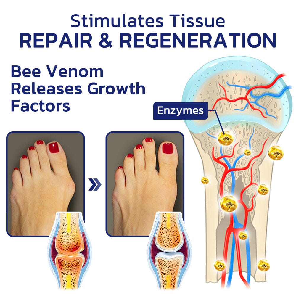 GFOUK™ Beeliefe Bee Venom Joint And Bone Therapy Cream 🐝